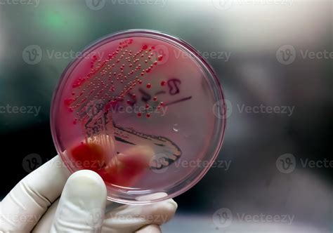 Colonies Of Bacteria In Macconkey Agar Culture Medium Plate Petri
