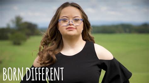Model With Down Syndrome Launches Fashion Line Born Different Hot
