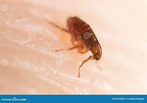 Flea On Human Skin Stock Image Image Of Tick Bite 96103261