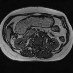 Would you like to add this location to your favourites? Faszie - DocCheck Flexikon