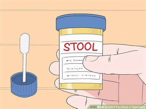 How To Tell If You Have A Tapeworm 12 Steps With Pictures