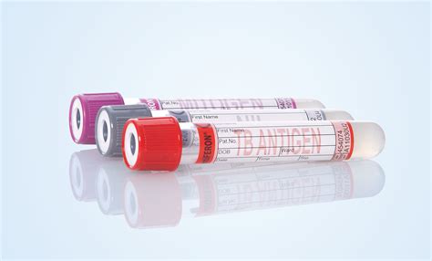 QuantiFERON-TB Gold (QFT) Kit