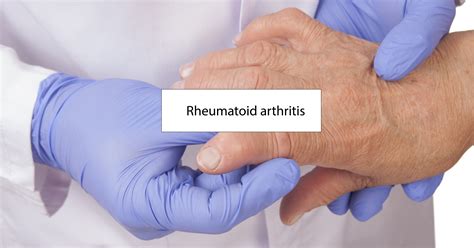 Rheumatoid Arthritis Symptoms Effects And Treatment