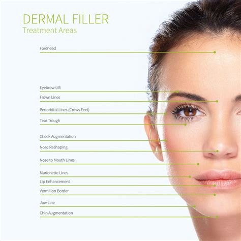 Dermal Fillers Treatment Areas Evolve Private Aesthetics Clinic Bolton