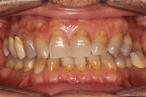 Old Before And After 425 Dental