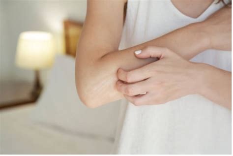 7 Ways To Relieve Itching Skin 2022