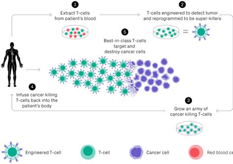 What Is Car T Cell Therapy