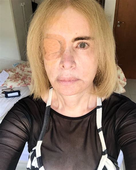 Musa Dos Anos 80 Isis De Oliveira Passa Por Cirurgia Em Olho Visão Comprometida Quem