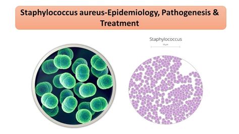 Staphylococcus Aureus Epidemiology Pathogenesis Treatment