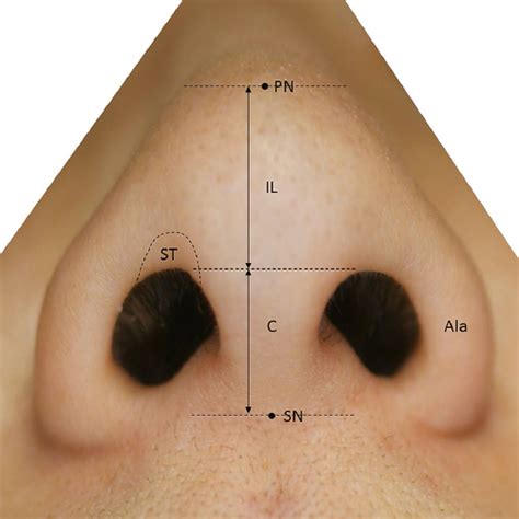 External Nose Plastic Surgery Key