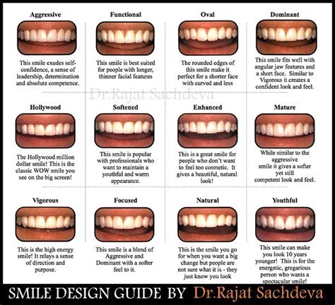 Dental Smile Design Analysis Smile Design Analysis Dental Care Affordable Dental