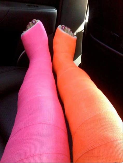 Long Leg Cast Orthopedic Brace Broken Leg Over Knee Boot It Cast Legs Boots Girl Collection
