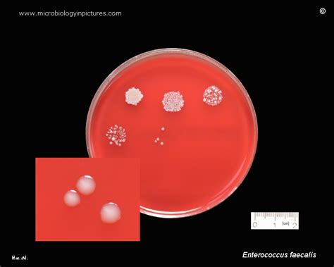 Enterococcus Faecalis Growth On Blood Agar Plate Efaecalis Morphology