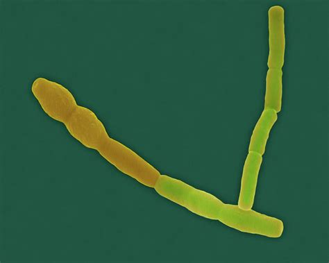 Bacillus Cereus Photograph By Dennis Kunkel Microscopyscience Photo