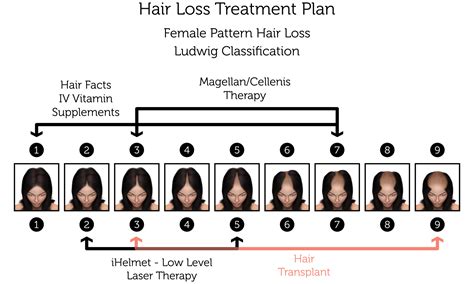 Female Pattern Hair Loss Treatment Rejuvence Clinic