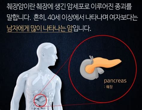 췌장 암의 조기 증상은 종종 없거나 미미합니다. 췌장암초기증상과 진단방법 : 네이버 블로그