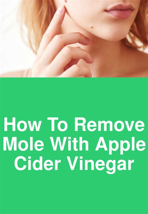 How To Remove Mole With Apple Cider Vinegar Mole Removal