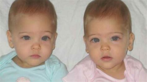 As Gêmeas ‘mais Lindas Do Mundo Cresceram E A Beleza Chega A Chocar