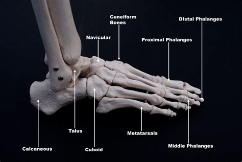 Th Metatarsal Fractures Newcastle Physiotherapy