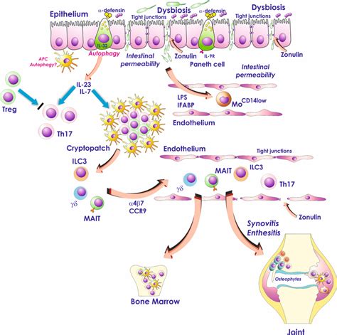 Role Of The Gut Inflammation In The Pathogenesis Of Ankylosing