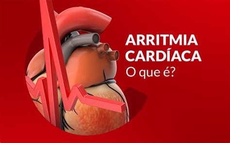 Arritmia Sinusal Pode Matar