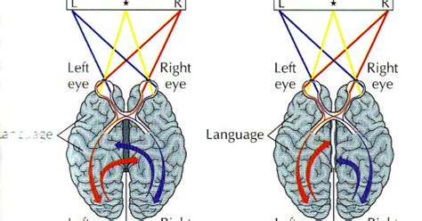 Split Brain ~ Ap Psychology