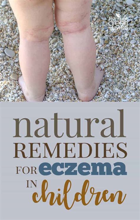 We offer best homeopathic medicines for eczema online at very reasonable price. Home Remedies for Eczema in Children - Five Spot Green Living