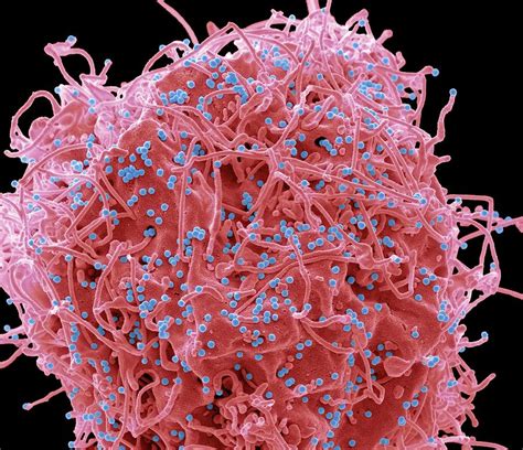 Hiv Infected Cell Photograph By Steve Gschmeissnerscience Photo
