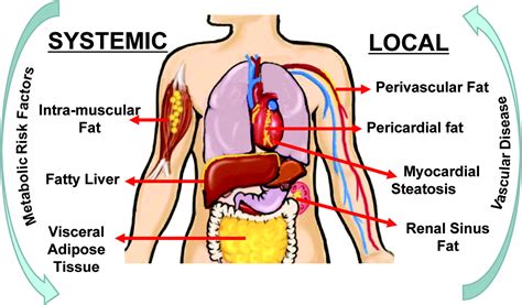 Ectopic Fat Depots And Cardiovascular Disease Circulation