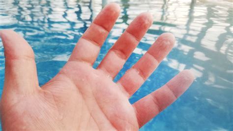 why do our hands get wrinkly in water 5 things to know