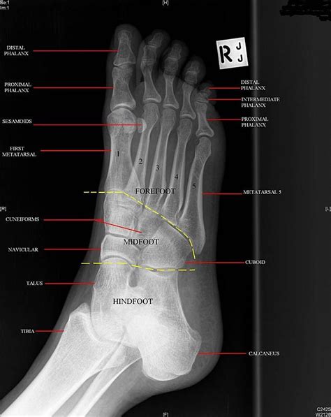 Learn anatomy faster and remember everything you learn. anatomy musculoskeletal x ray - Google Search | Foot ...