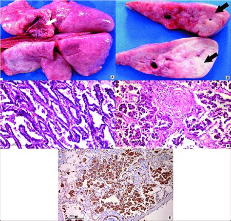 Canine Lepidic Predominant Adenocarcinoma A Diffuse Whitish Homogenous