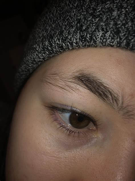 Have Had Half Eyebrows Like This For My Whole Life Its Been A Huge