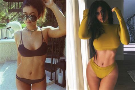 The Secret Plastic Surgery Celebs Are Having To Sculpt Their Curves