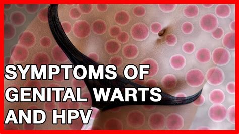 Symptoms Of Genital Warts And Hpv Youtube