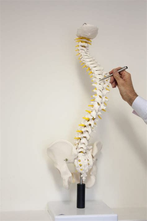 Scoliosis Screening Uk Archives Scoliosis Clinic Uk Treating