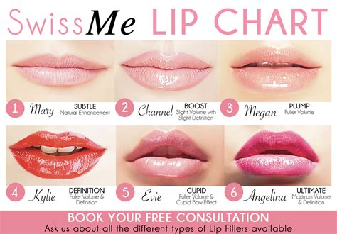 Lip Filler Chart