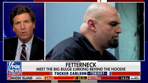 Tucker Carlson Calls Out Large Bump On John Fettermans Neck ‘keep