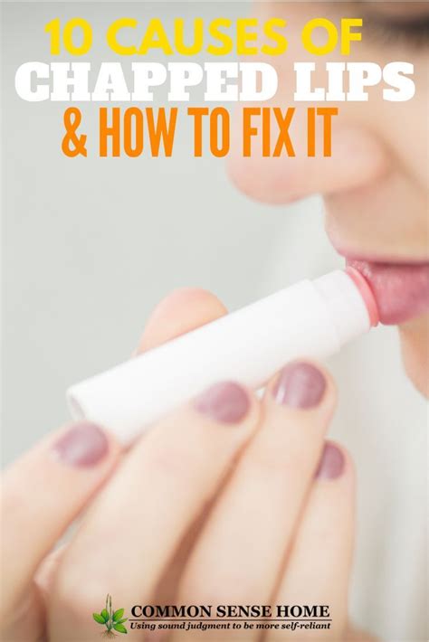 10 Chapped Lips Causes Plus How To Get Rid Of Chapped Lips Health