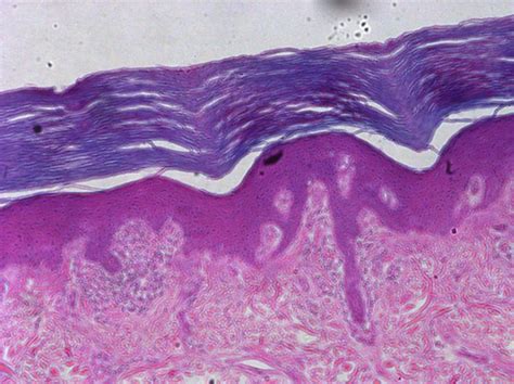 Aandp Skin Histology Flashcards Quizlet