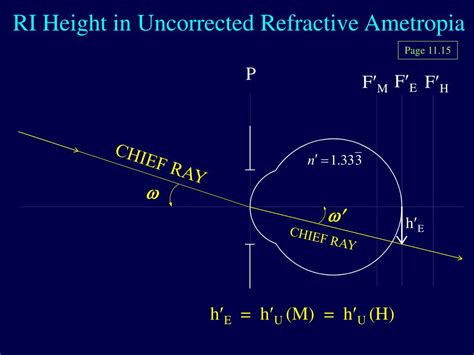 Ppt Retinal Image Height Anisometropia And Aniseikonia Powerpoint