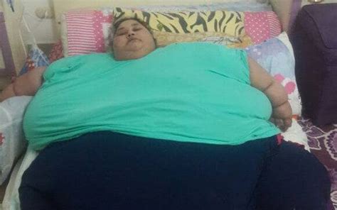 Worlds Heaviest Woman At 78st Undergoes Weight Loss Surgery