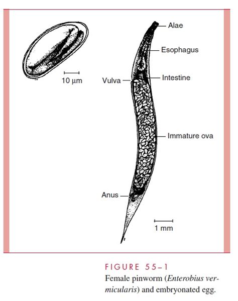 Enterobius Vermicularis Pinworm Parasitology