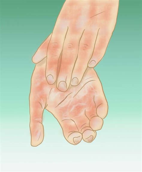 How To Fix Bad Circulation In The Hands And Feet My Experience