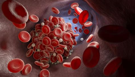 Possible Cause Of Covid 19 Blood Clots Found Live Science