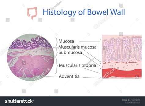 Histology Colon Wall Illustration Microscopical Photo Stock Photo