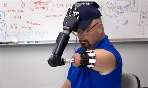 Heres The Worlds Most Advanced Bionic Arm