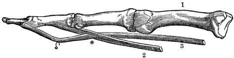 Metacarpal And Phalangeal Bones Of The Fingers Clipart Etc