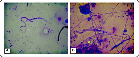 A And B Epimastigote Form Of Trypanosoma Rangeli At X Magnifi Download Scientific Diagram
