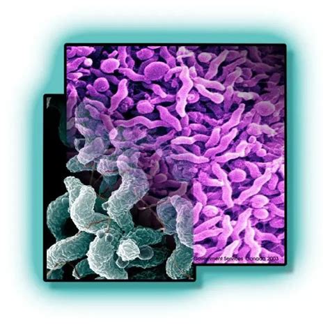 Campylobacter Jejuni Disease Properties And Laboratory Diagnosis